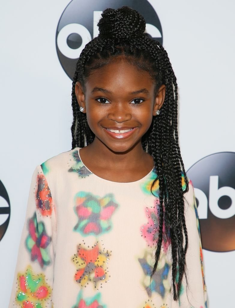 20 Stylish Cornrow Hairstyles for Little Girls in 2024